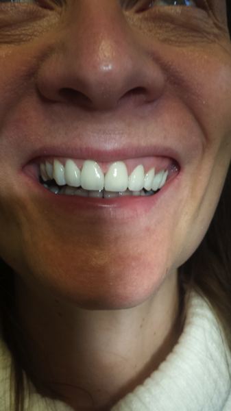 Bilder: Zahnersatz, Mundhygiene, Implantate | Zahnarzt Wien - Dr.Pilus